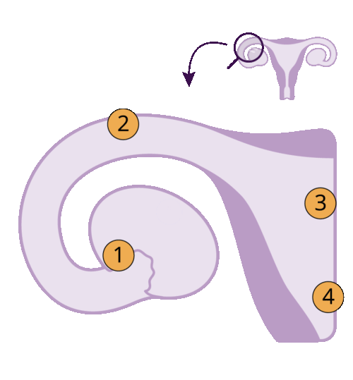 Weg der Eizelle durch den Eileiter bis zur Einnistung in der Gebärmutterschleimhaut als Infografik dargestellt.